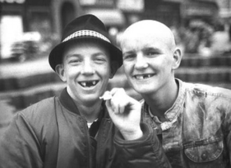 skinhead 77